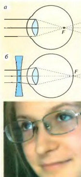 Близорукость. Дальнозоркость. Очки