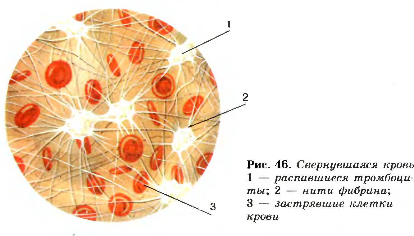 Свернувшаяся кровь