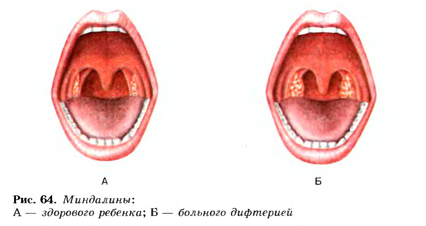 Мендалины