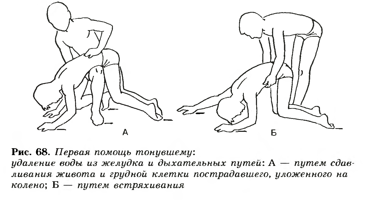 Первая помощь утопающему.