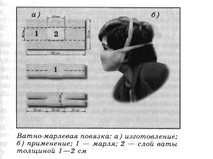 Ватно-марлиевая повязка